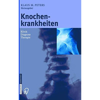 Knochenkrankheiten: Klinik Diagnose Therapie [Paperback]