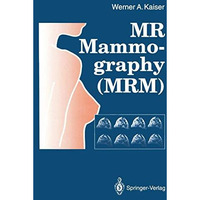 MR Mammography (MRM) [Paperback]