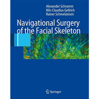 Navigational Surgery of the Facial Skeleton [Paperback]