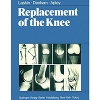 Replacement of the Knee [Paperback]