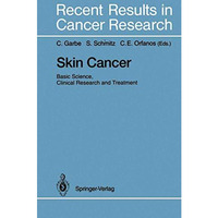 Skin Cancer: Basic Science, Clinical Research and Treatment [Paperback]