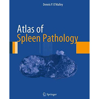 Atlas of Spleen Pathology [Paperback]