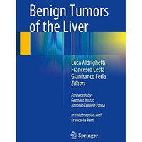 Benign Tumors of the Liver [Hardcover]