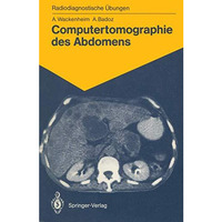 Computertomographie des Abdomens: 85 diagnostische ?bungen f?r Studenten und pra [Paperback]