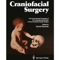 Craniofacial Surgery: Proceedings of the First International Congress of The Int [Paperback]