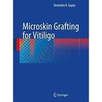 Microskin Grafting for Vitiligo [Hardcover]