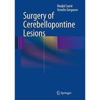 Surgery of Cerebellopontine Lesions [Hardcover]