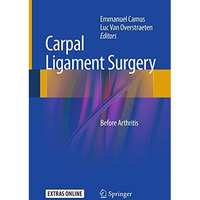 Carpal Ligament Surgery: Before Arthritis [Paperback]