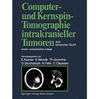 Computer- und Kernspin-Tomographie intrakranieller Tumoren aus klinischer Sicht [Paperback]