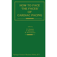 How to face the faces of CARDIAC PACING [Paperback]