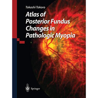 Atlas of Posterior Fundus Changes in Pathologic Myopia [Paperback]