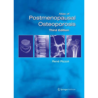 Atlas of Postmenopausal Osteoporosis: Third Edition [Paperback]