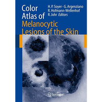 Color Atlas of Melanocytic Lesions of the Skin [Paperback]