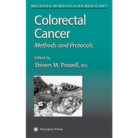 Colorectal Cancer: Methods and Protocols [Paperback]