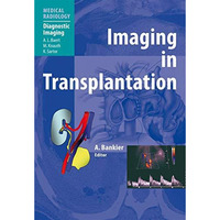 Imaging in Transplantation [Paperback]