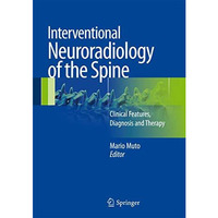 Interventional Neuroradiology of the Spine: Clinical Features, Diagnosis and The [Hardcover]