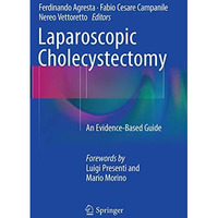 Laparoscopic Cholecystectomy: An Evidence-Based Guide [Paperback]