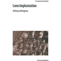 Lens Implantation: 30 Years of Progress [Paperback]