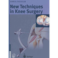 New Techniques in Knee Surgery [Paperback]