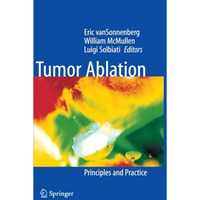 Tumor Ablation: Principles and Practice [Paperback]