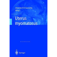 Uterus myomatosus [Paperback]