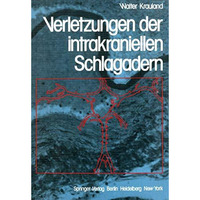 Verletzungen der intrakraniellen Schlagadern [Paperback]