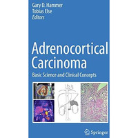 Adrenocortical Carcinoma: Basic Science and Clinical Concepts [Hardcover]