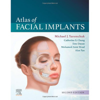 Atlas of Facial Implants [Hardcover]