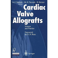 Cardiac Valve Allografts: Science and Practice [Paperback]