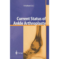 Current Status of Ankle Arthroplasty [Paperback]