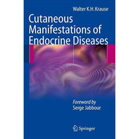 Cutaneous Manifestations of Endocrine Diseases [Paperback]