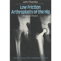 Low Friction Arthroplasty of the Hip: Theory and Practice [Paperback]