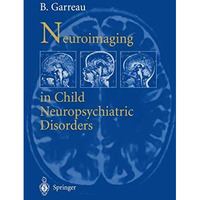 Neuroimaging in child neuropsychiatric disorders [Paperback]