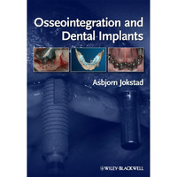 Osseointegration and Dental Implants [Hardcover]