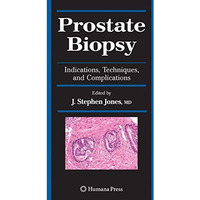 Prostate Biopsy: Indications, Techniques, and Complications [Paperback]