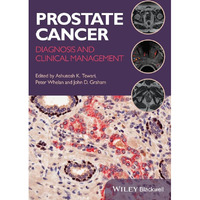 Prostate Cancer: Diagnosis and Clinical Management [Paperback]