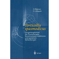 Torticollis spasmodicus: Langzeitergebnisse der Physiotherapie, Botulinumtoxin-I [Paperback]