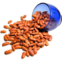 Nirav Red Kidney Beans (Rajma) - 4 lbs - PACK of 6 (6 x 4 lbs bag)