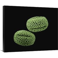 Olive (Olea europaea) pollen at 1400x magnification-Canvas Art-36"x29.88"