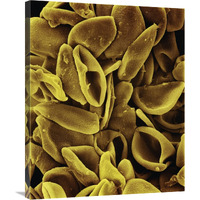 Daffodil (Narcissus sp) pollen on anther at 700x magnification-Canvas Art-28"x35"