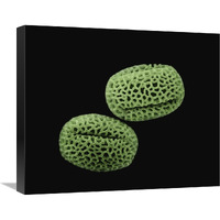 Olive (Olea europaea) pollen at 1400x magnification-Canvas Art-22&quotx18.26"