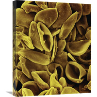 Daffodil (Narcissus sp) pollen on anther at 700x magnification-Canvas Art-20"x24"