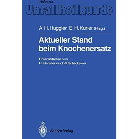 Aktueller Stand beim Knochenersatz [Paperback]