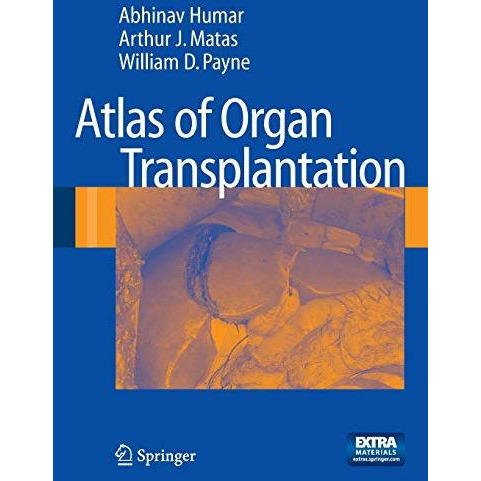 Atlas of Organ Transplantation [Paperback]