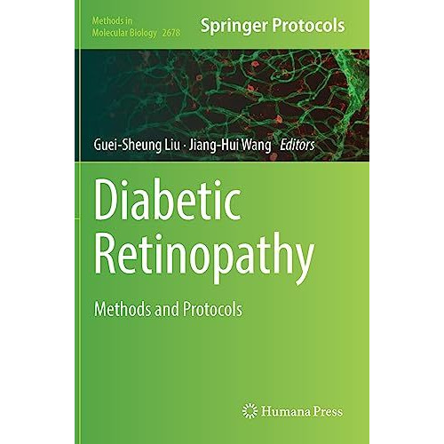 Diabetic Retinopathy: Methods and Protocols [Hardcover]