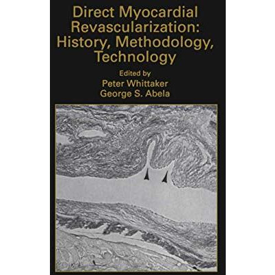 Direct Myocardial Revascularization: History, Methodology, Technology [Hardcover]