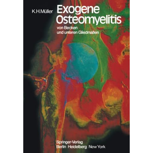 Exogene Osteomyelitis von Becken und unteren Gliedma?en: Besonderheiten Pathogen [Paperback]