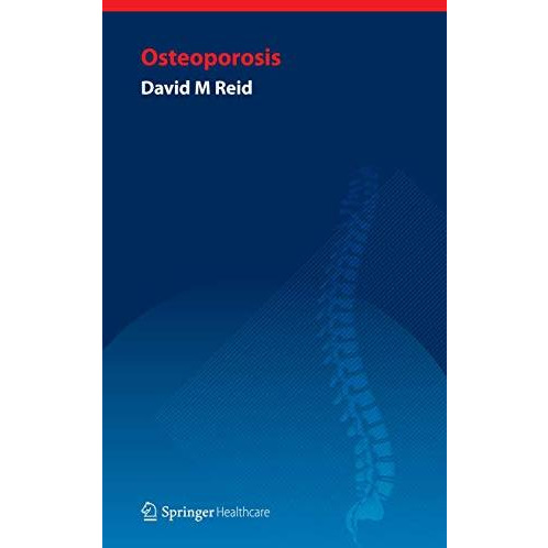 Handbook of Osteoporosis [Paperback]