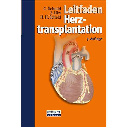 Leitfaden Herztransplantation [Paperback]