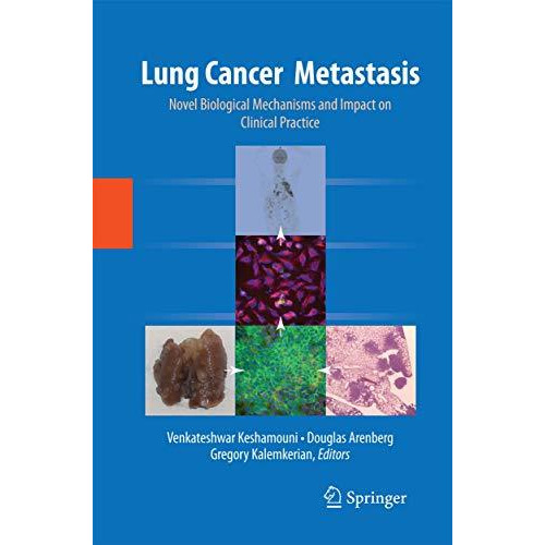 Lung Cancer Metastasis: Novel Biological Mechanisms and Impact on Clinical Pract [Paperback]